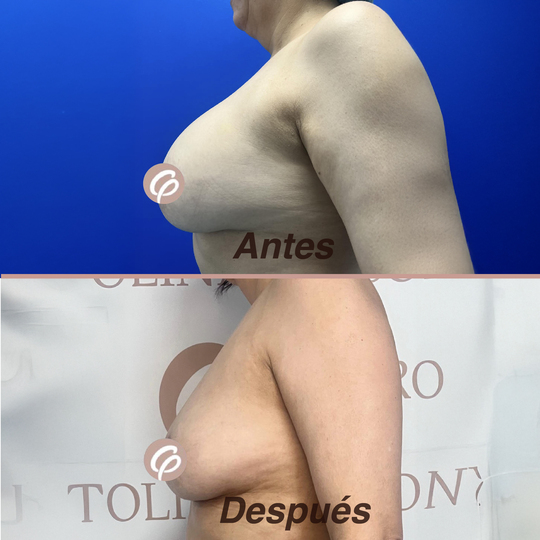 antess-y-despues