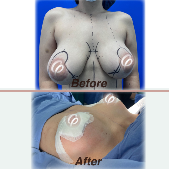 before and after 9.jpg